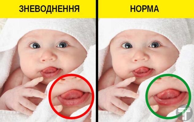 Ротавірус у дитини: симптоми, лікування та профілактика захворювання