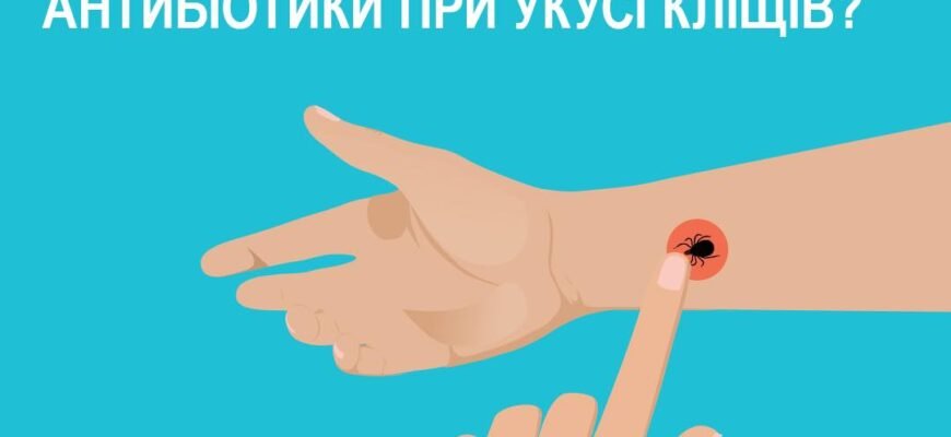 Який антибіотик при укусі кліща: вибір і рекомендації