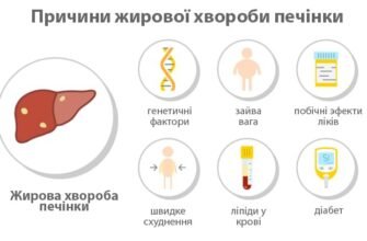 Метаболічно асоційована хвороба печінки: причини та лікування