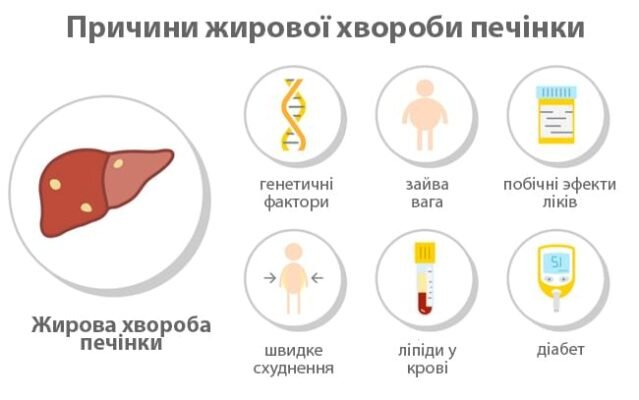 Метаболічно асоційована хвороба печінки: причини та лікування