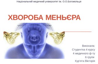 Хвороба Меньєра: симптоми, причини та лікування
