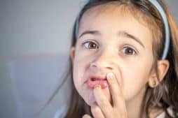 Стоматит у дитини: основні причини, симптоми та методи лікування