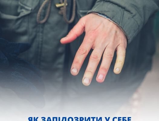 Чи виліковна хвороба Рейно: сучасні методи лікування та діагностика