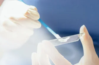 Сквамозні інтраепітеліальні зміни низького ступеню: що потрібно знати?