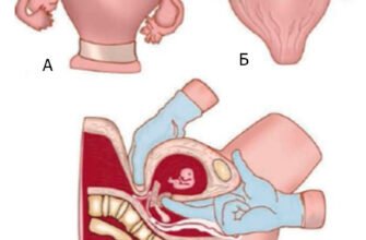 Як виглядає шийка матки при вагітності: ознаки та зміни
