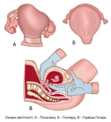 Як виглядає шийка матки при вагітності: ознаки та зміни