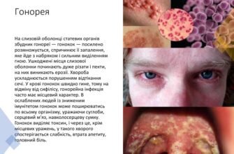 Причини та лікування статевих інфекцій у чоловіків: повний гайд