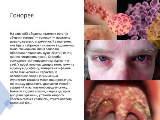 Причини та лікування статевих інфекцій у чоловіків: повний гайд