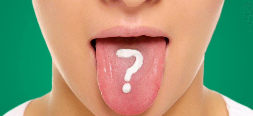 Яка хвороба викликає сухість в роті: основні причини та симптоми
