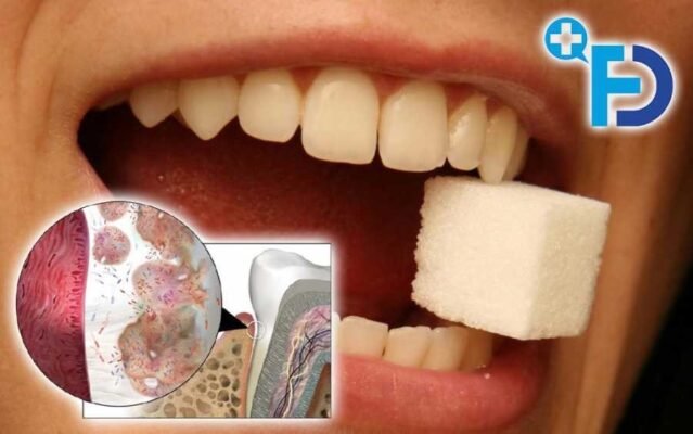 Язик при цукровому діабеті: симптоми, причини та лікування