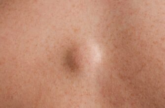 Обговорення: гулька на голові у дитини – поради та досвід батьків