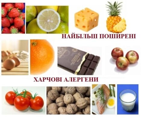 Що не можна їсти при алергії: ключові продукти для уникнення