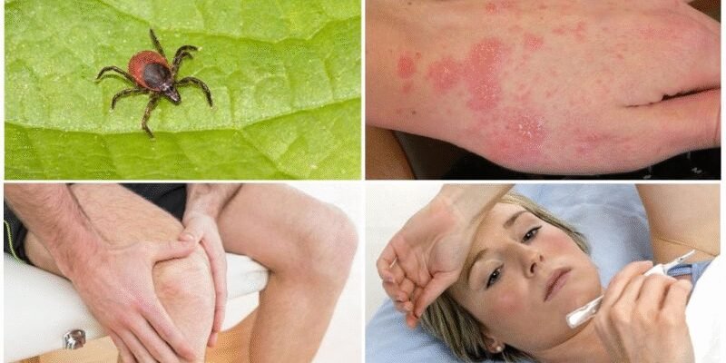 Хвороба Лайма у дітей: симптоми, діагностика та лікування