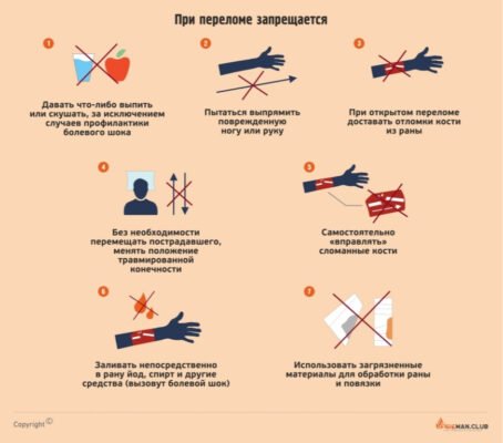 Перша допомога при переломі: як правильно діяти та допомогти потерпілому