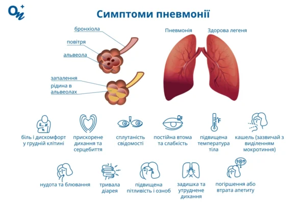 Температура при запаленні легень: норми, ризики та лікування