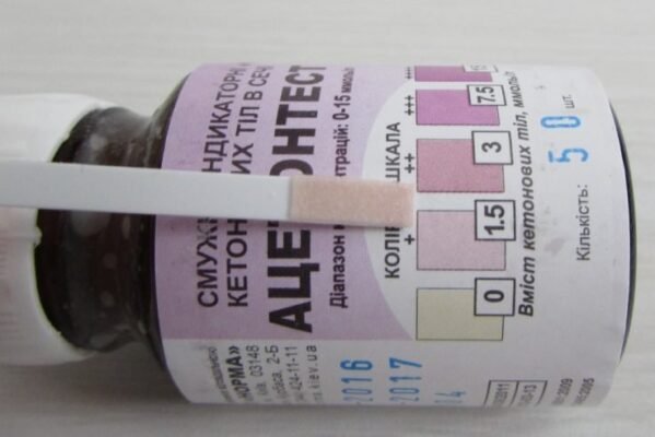 Як збити ацетон у дитини в домашніх умовах: ефективні методи