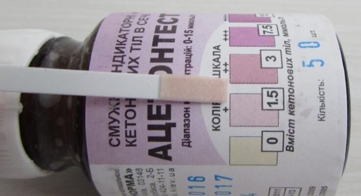 Як збити ацетон у дитини в домашніх умовах: ефективні методи