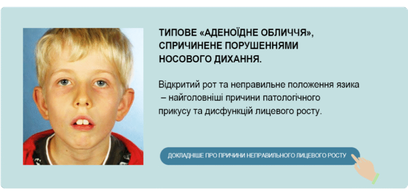 Аденоїдне обличчя у дитини: причини, симптоми та лікування