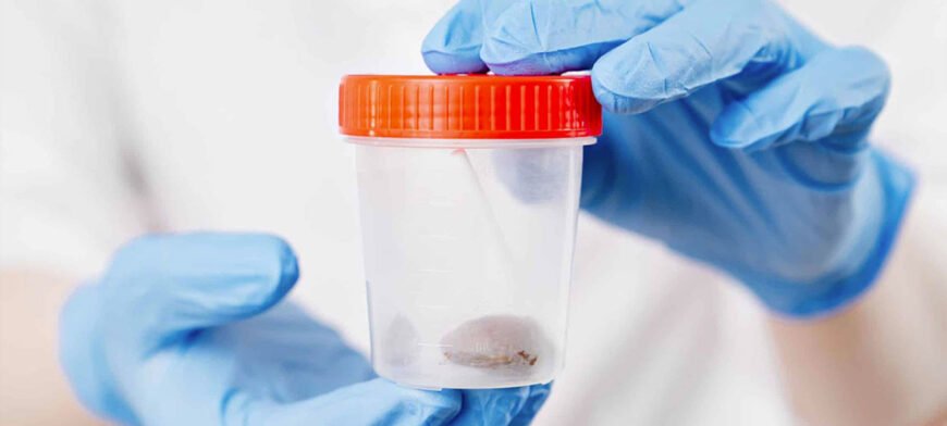 ПЛР калу на кишкові інфекції: точність діагностики та переваги аналізу