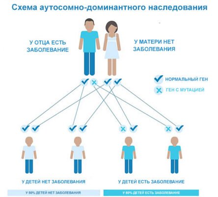 Хантінгтон хвороба: симптоми, діагностика та лікування патології