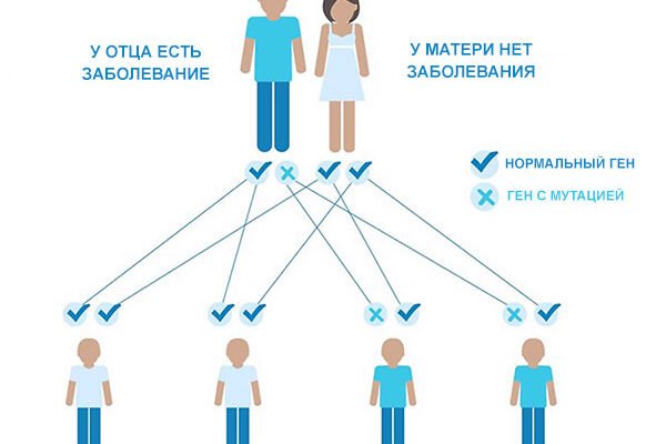Хантінгтон хвороба: симптоми, діагностика та лікування патології
