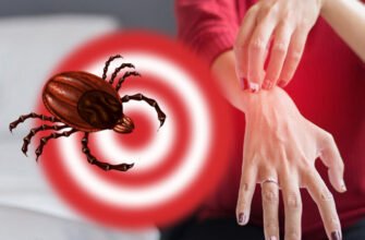 Захворювання: причини, симптоми та методи лікування хвороби