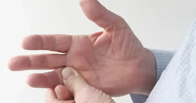 Лікування хвороби Нотта: сучасні методи та рекомендації лікарів