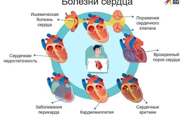 Хвороби серця, при яких не можна займатися любов’ю: важливі поради