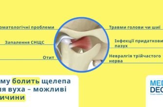 Причини болю в щелепі при відкриванні рота: що варто знати?