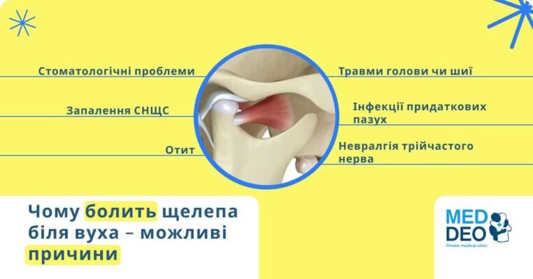 Причини болю в щелепі при відкриванні рота: що варто знати?