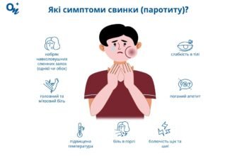Симптоми свинки у дітей: як розпізнати хворобу вчасно?