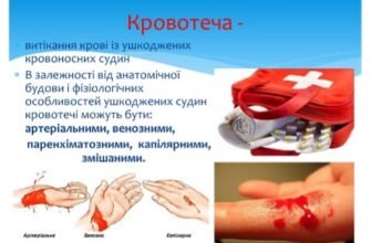 Перша допомога при кровотечі: ефективні способи зупинки крові