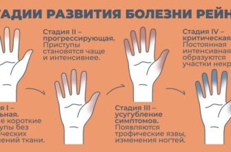 Раціон харчування при синдромі Рейно: продукти та поради лікарів