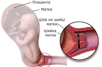 Шийка матки при вагітності: особливості змін і важливість моніторингу