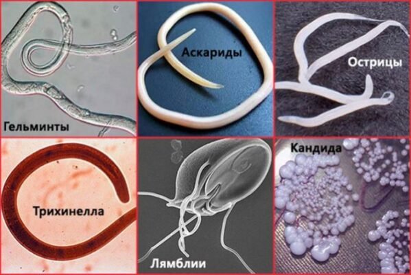Як самостійно перевірити чи є у дитини глисти: Корисні поради для батьків