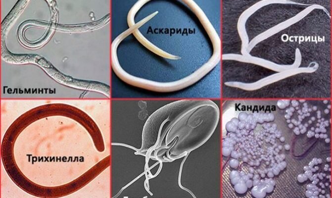 Як самостійно перевірити чи є у дитини глисти: Корисні поради для батьків