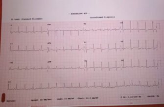 Дистрофічні зміни міокарда: причини, симптоми та лікування