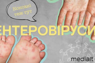 Висип на ногах у дитини: причини та фото для розпізнання