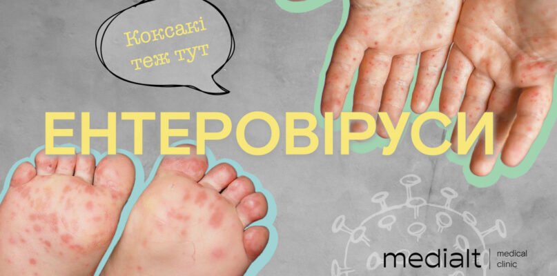 Висип на ногах у дитини: причини та фото для розпізнання