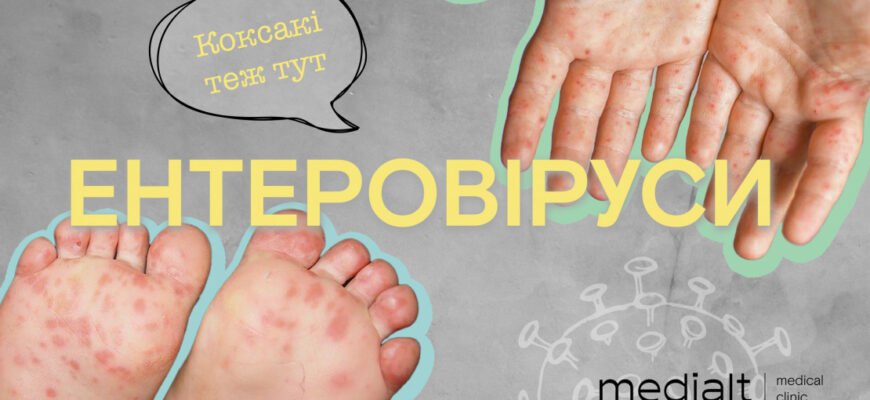 Висип на ногах у дитини: причини та фото для розпізнання