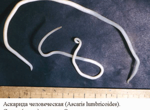 Глисти у дитини: фото для розпізнавання та профілактичні поради