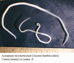 Глисти у дитини: фото для розпізнавання та профілактичні поради Глисти у дитини: фото для розпізнавання та профілактичні поради