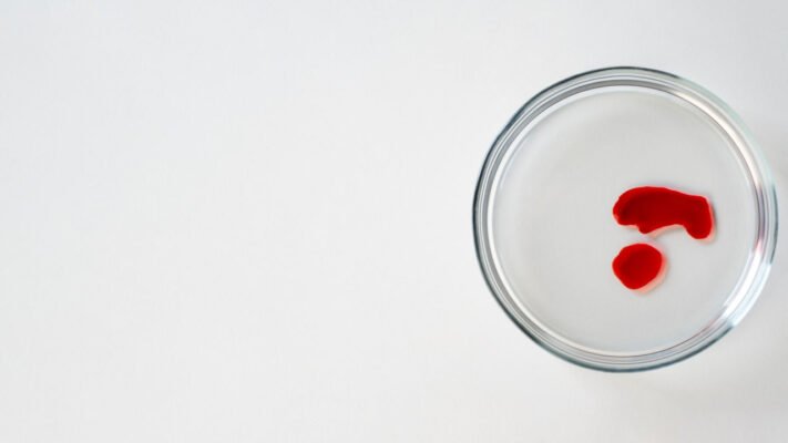 Симптоми низького гемоглобіну у дитини: як розпізнати проблеми?