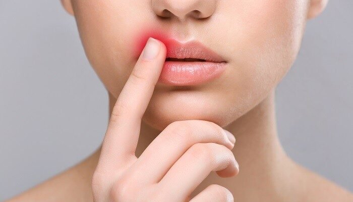 Герпес на губі при вагітності: причини, вплив і лікування