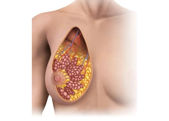 Інволютивні зміни молочних залоз: причини, симптоми та лікування