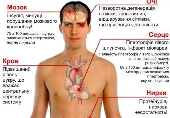 Гіпертонічна хвороба 1 стадія: симптоми, діагностика, лікування