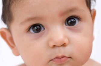 Мішки під очима у дитини: причини, наслідки, рішення