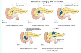 Реактивні зміни підшлункової залози: причини та ознаки