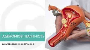 Чи можна завагітніти в 60 років: міфи та реальні можливості