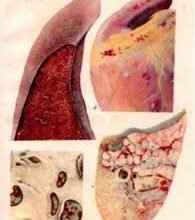 Хвороба Кона: симптоми, діагностика та методи лікування аденоми